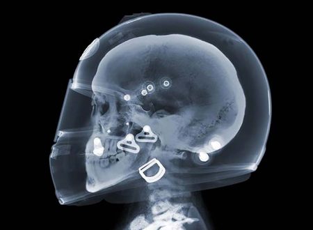 Motorcycle Helmet X-Ray